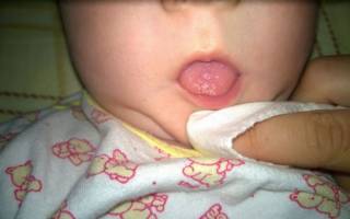 Осмотр губ новорожденного