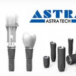 Импланты AstraTech