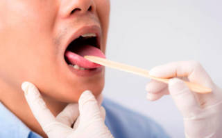 Диагностический осмотр полости рта