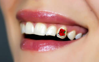 Наклейка цветок на зубе