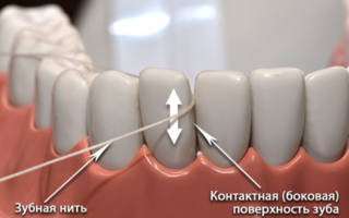 Как использовать зубную нить