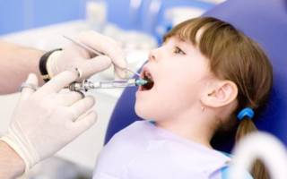 Анестезия ребенку в стоматологии
