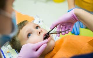 Удаление молочного зуба в стоматологии