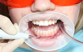 Начальный этап чистки зубов