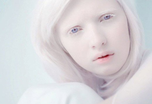 девушка альбинос