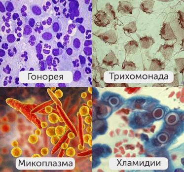 Бактерии венерических болезней