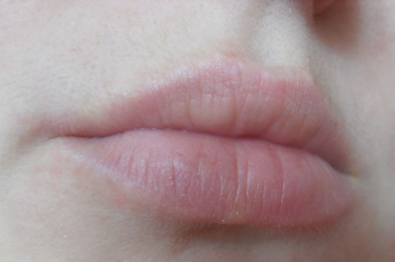 Бледные губы