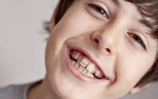Кривые зубы у мальчика