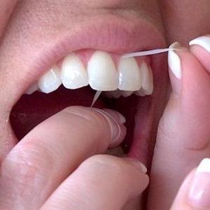 Чистка зубов нитью