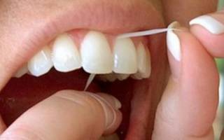 Чистка коронок зубной нитью