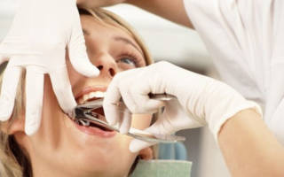 Хирург удаляет зуб