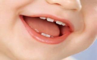 Молочные зубы