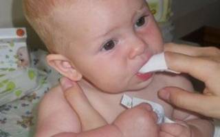 Обработка рта новорожденного