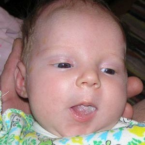 Молочный налет на языке у малыша