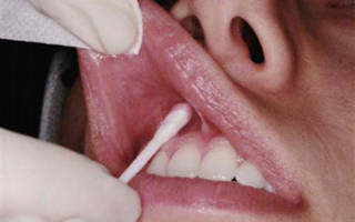 Нанесение анестезии на зубы