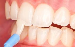 Нанесение состава на зубы