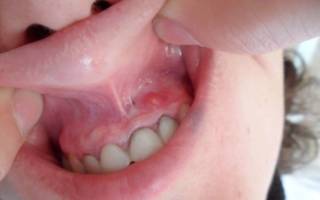 Почему болит челюсть возле уха: находим и устраняем причину