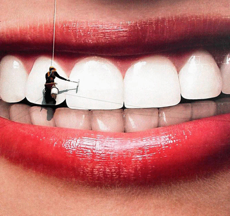 Девушке отбеливают зубы