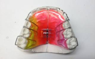 Цветная пластина для зубов