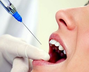 Лидокаин в стоматологии