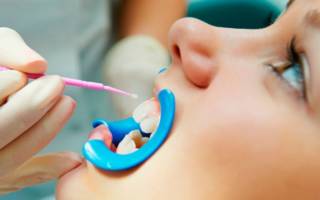 Процедура чистки зубов