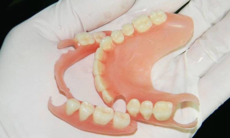 Пластиночный зубной протез