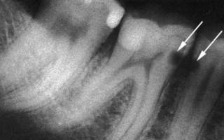 Стоматолог смотрит рентген зубов