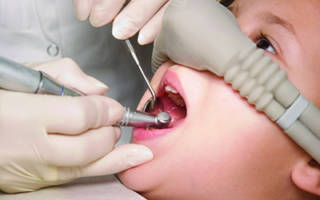 Лечение зубов ребенка под седацией