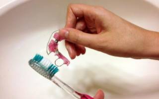 Чистка зубной пластины