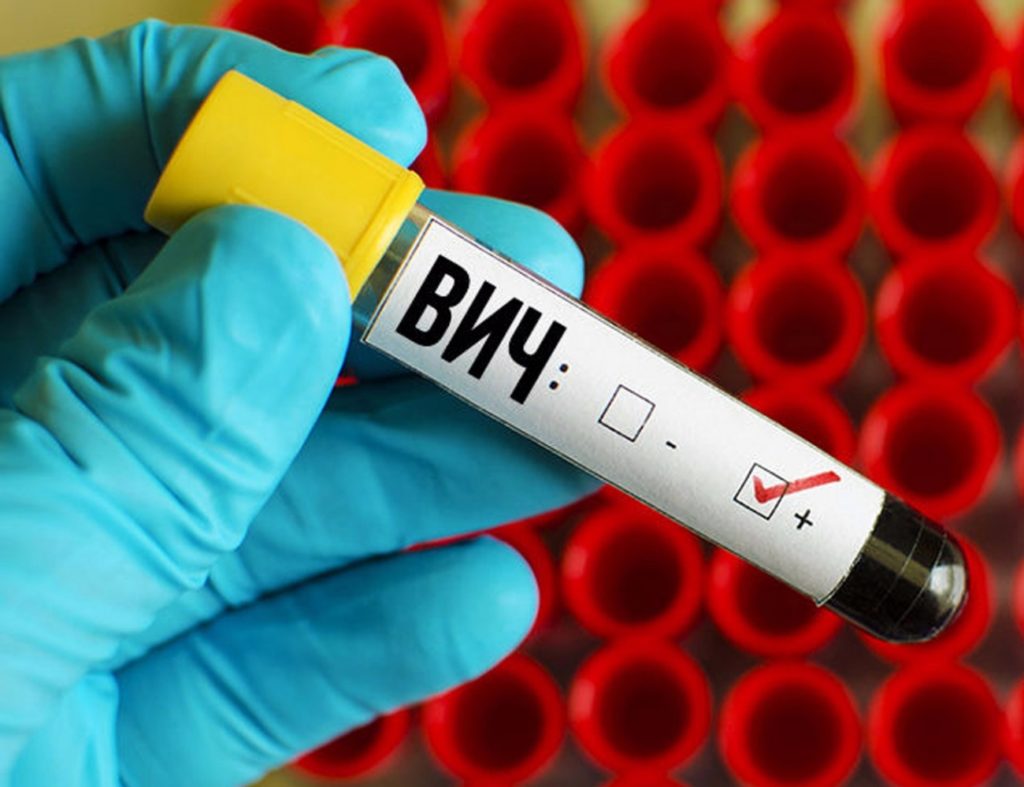 Пробирка с кровью при ВИЧ-инфекции