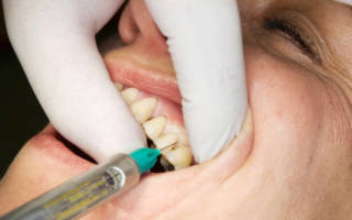 Анестезия зуба