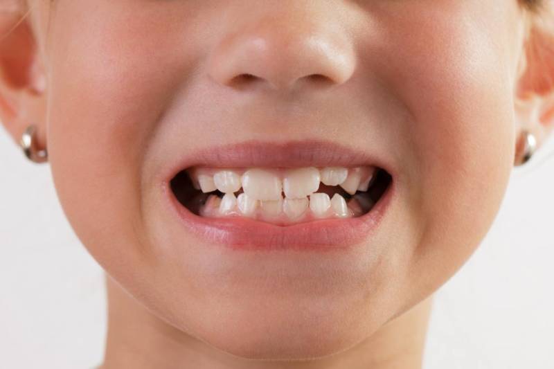 Коренные зубы у ребенка