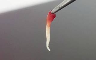 Как выглядит зубной нерв
